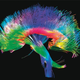 Illustration for article titled How to Live Forever By Turning Your Brain Into Plastic
